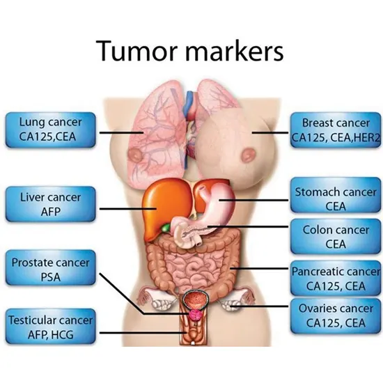 Any 3 Cancer Marker
